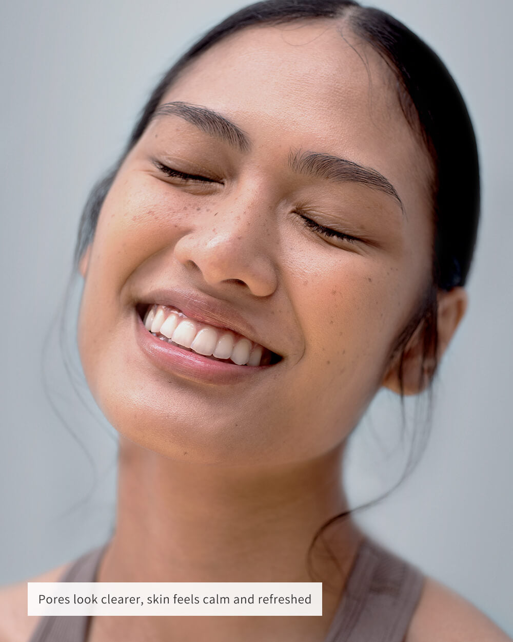 🔥💞LAST DAY 75% OFF ✨✨🧄Deep-Clean Nose Strips – Removes Blackheads & Tightens Pores